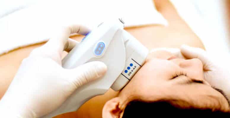 Ulthera Skin Tightening