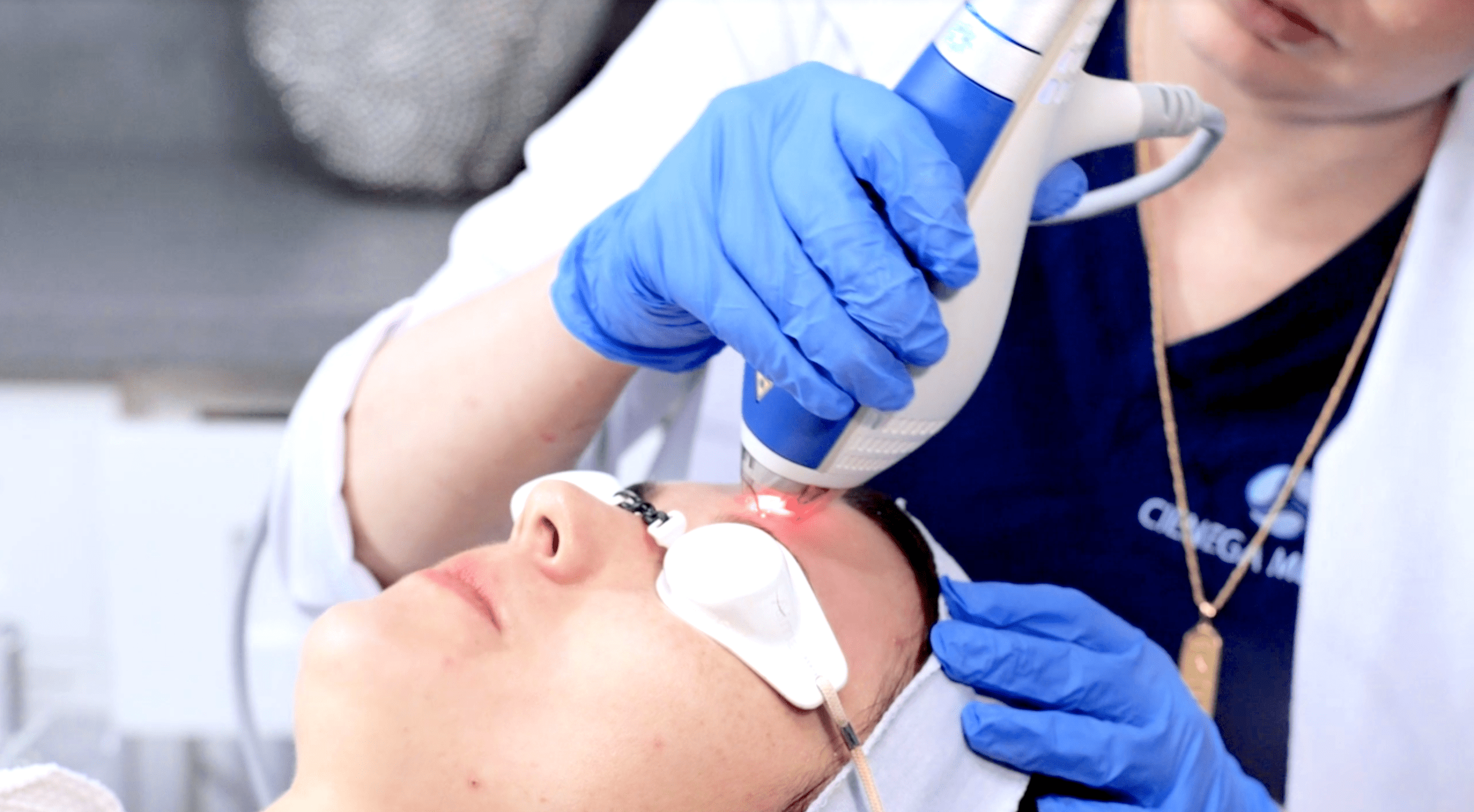 Clear and Brilliant Laser Facial