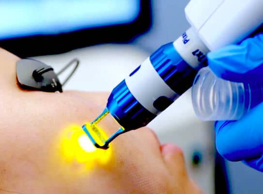 Pixel Laser Resurfacing